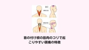 首の付け根の筋肉のコリで起こりやすい頭痛の特徴