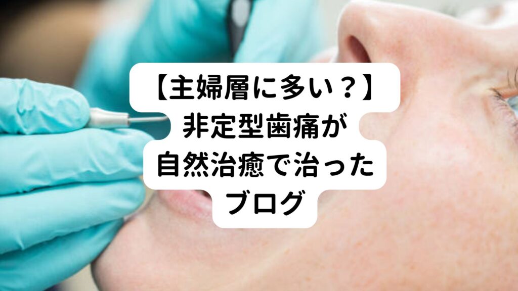 【主婦層に多い？】非定型歯痛が自然治癒で治ったブログ