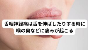 舌咽神経痛は舌を伸ばしたりする時に喉の奥などに痛みが起こる舌咽神経痛は舌を伸ばしたり、物を噛んだり飲み込んだりする時に喉や舌の奥や耳の周りに痛みが現れる症状をいいます。
舌咽神経痛は、神経痛の中でも非常に痛みが強い病気とされています。

痛みの程度は、三叉神経痛と同じくらいとされており電撃が走るような強い痛みがあるとされています。
そのため痛みが強くなると、つばを飲み込んだだけでも痛みが現れるようになります。