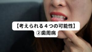 4つの可能性の中ではこれが最も高いといえます。
「歯磨きしても口の中がネバネバする、口臭を感じる」、いずれも歯周病の症状に該当しています。

歯周病になると歯周ポケットという溝に細菌が溜まりやすくなります。
しかし、この溝の汚れは簡単な歯磨きでは除去できません。
やがて歯周ポケットの中で細菌が増殖し、口臭を引き起こすとされています。

また、歯周病によって起こる歯肉からの出血や膿も口臭を招きます。
そのため健康な状態に比べると歯磨きをした後でもネバつきや口臭が残りやすい傾向にあります。