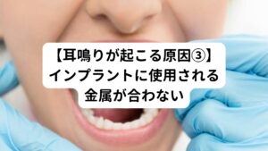 インプラントには金属が使用されています。
一般的には金属アレルギーの方でも大丈夫な金属が使用されますが、アレルギーが起こる可能性が0であるというわけではありません。

この金属アレルギーが耳鳴りの原因となることもあります。
とくに口腔内にタイプが違う金属が複数入ると、「ガルバニー電流」という弱い電気が発生します。
このガルバニー電流が耳鳴りを引き起こすとされています。

食事に使われていたアルミホイルを間違えて口の中に入れ、噛んでしまったときにビリッと感じたことはないでしょうか。
これがガルバニー電流なのですが、インプラントの被せ物に反応しても同様の電気が走り、耳鳴りなどにつながる恐れがあります。