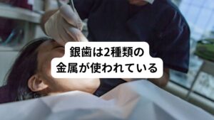 実は、銀歯の金属には種類があることをご存じでしょうか。
保険適用の金属には以下のようなものがあります。

・アマルガム
・金銀パラジウム合金