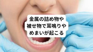 こういった詰め物に使われている金属が原因で金属アレルギーに悩まされている方が多くいらっしゃいます。
特に保険診療の治療で使われていたアマルガムという歯科用金属は、水銀を約50％も含む金属です。
高温多湿の口腔内では劣化し、蒸発、腐食を続け、自覚のないまま体内に吸収、蓄積されていきます。

水銀には強い神経毒性もあり、耳鳴り、めまい、頭痛や肩こり、皮膚炎などのアレルギー症状のリスクがあります。
また自律神経の機能を低下させて不眠、イライラなど、様々な症状を引き起こすこともあります。

保険診療に使われる金銀パラジウム合金という金属は、携帯電話やパソコンが発する電磁波のアンテナとなる働きがあります。
そのため電磁波を体内に集めてしまう働きによる影響でめまいや耳鳴りの他、動悸、疲れやすい、集中できないなどの症状が出ることがあります。