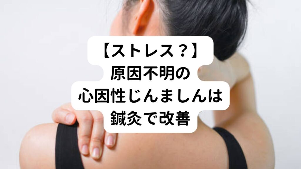 【ストレス？】原因不明の心因性じんましんは鍼灸で改善